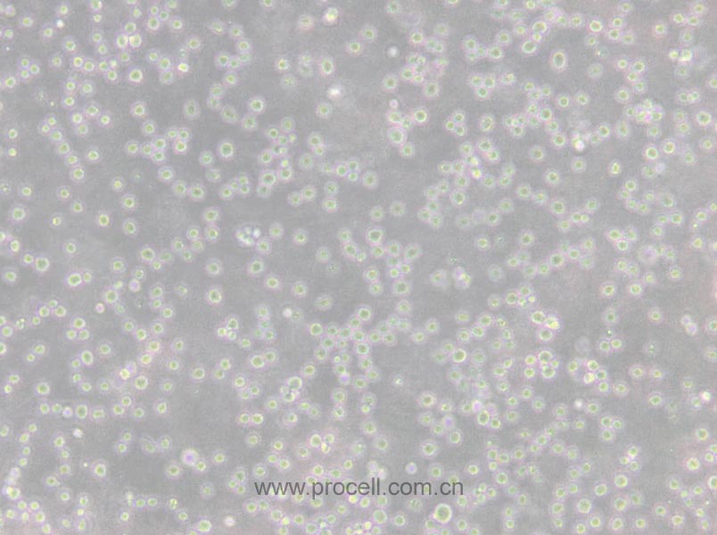 CCRF-CEM [CCRF CEM] (人急性淋巴细胞白血病T淋巴细胞) (STR鉴定正确)