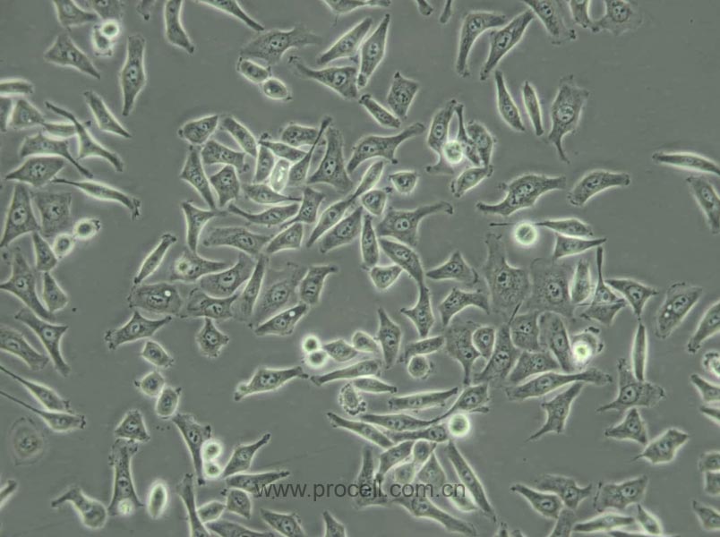 CNE (人鼻咽癌细胞) (Hela污染细胞系，暂不供应)