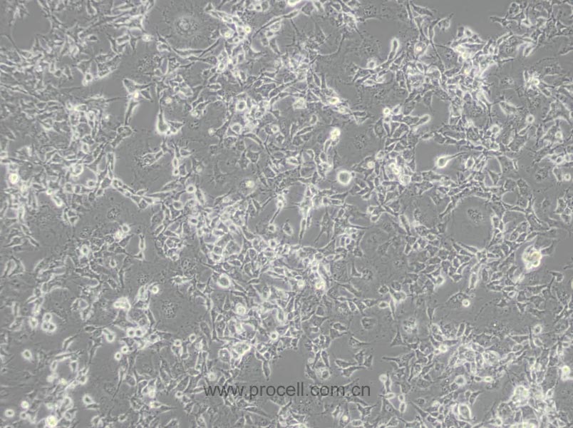 COS-1 (非洲绿猴SV40转化的肾细胞)