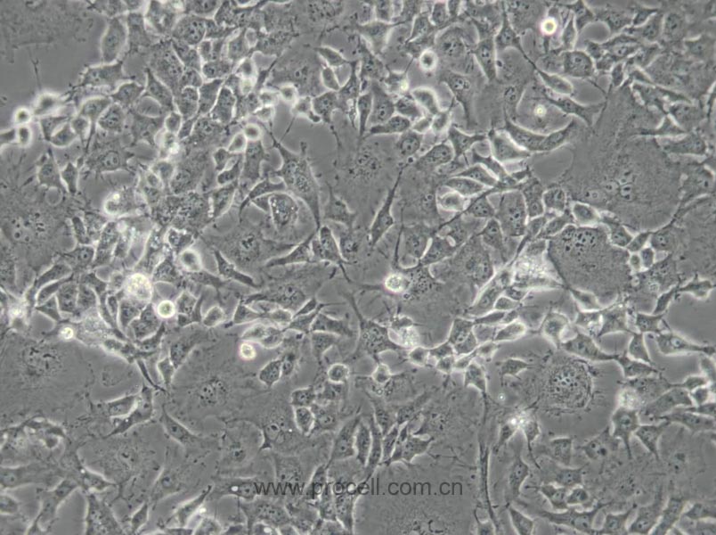 COS-1 (非洲绿猴SV40转化的肾细胞) (种属鉴定正确)