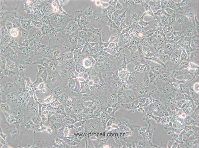 COS-7 (非洲绿猴SV40转化的肾细胞) (种属鉴定正确)