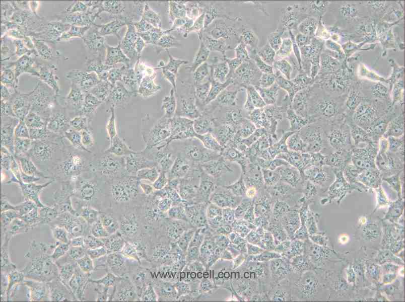 COS-7 (非洲绿猴SV40转化的肾细胞) (种属鉴定正确)