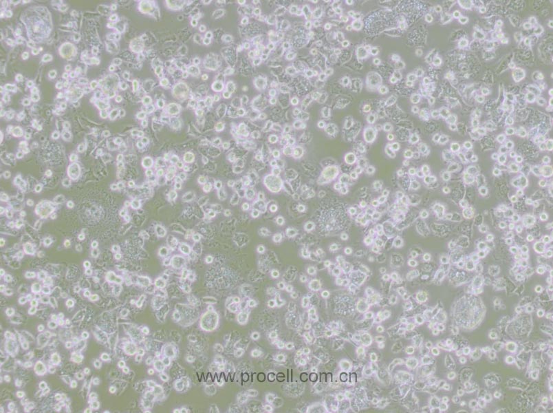 DH82 (犬巨噬细胞/狗肾恶性组织细胞增生症细胞)(种属鉴定正确)