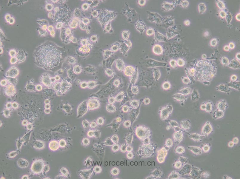 DH82 (犬巨噬细胞/狗肾恶性组织细胞增生症细胞)(种属鉴定正确)