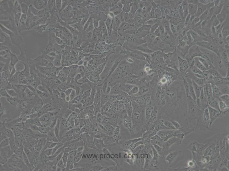 DLD-1 (人结直肠腺癌上皮细胞) (STR鉴定正确)