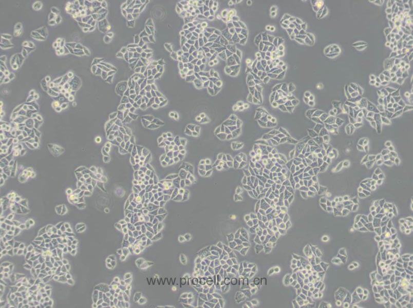 Eca-109 (人食管癌细胞) (Hela污染细胞系，暂不供应)