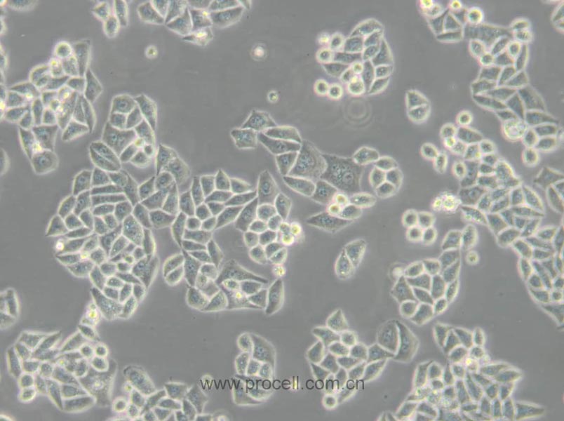 Eca-109 (人食管癌细胞) (Hela污染细胞系，暂不供应)