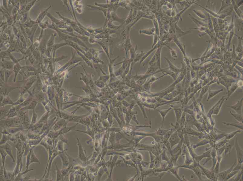 ES-2 (人卵巢透明细胞癌细胞) (STR鉴定正确)