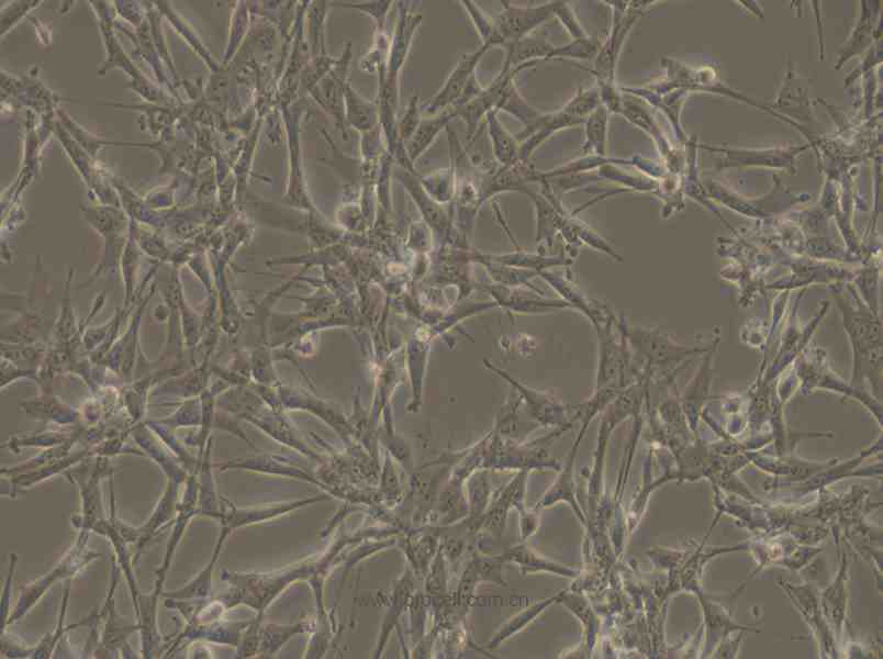 ES-2 (人卵巢透明细胞癌细胞) (STR鉴定正确)