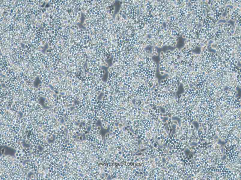F9 (小鼠畸胎瘤细胞/小鼠胚胎癌细胞) (种属鉴定正确)