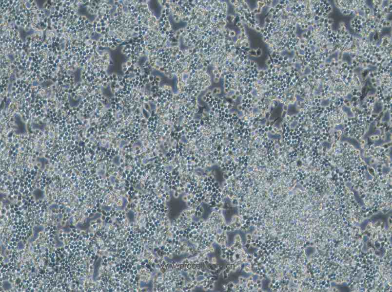 F9 (小鼠畸胎瘤细胞/小鼠胚胎癌细胞) (STR鉴定正确)