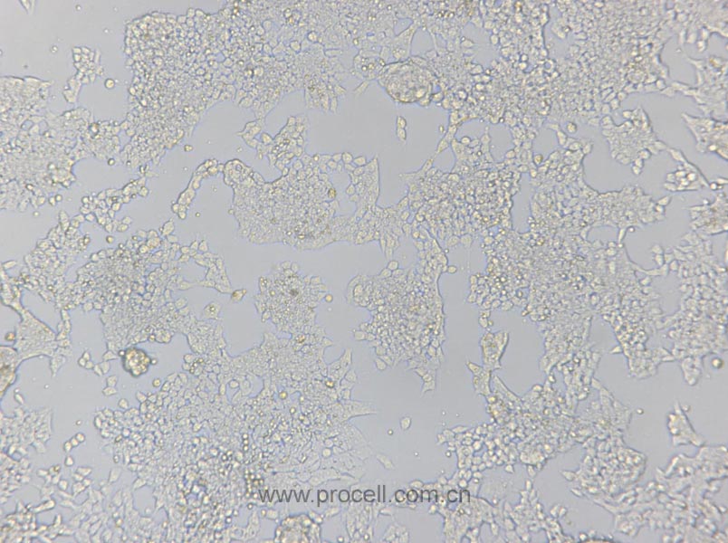 F9 (小鼠畸胎瘤细胞/小鼠胚胎癌细胞) (种属鉴定正确)