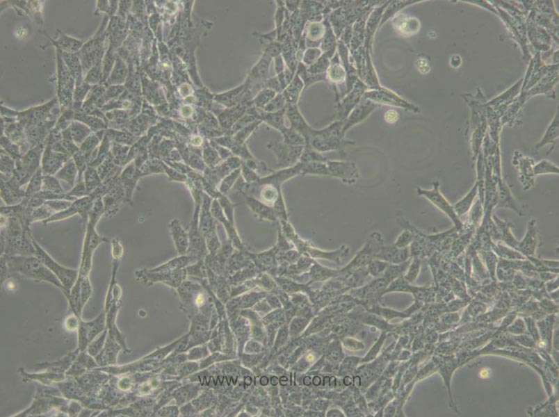 HBL-100 (人整合SV40基因的乳腺上皮细胞) (STR鉴定正确)