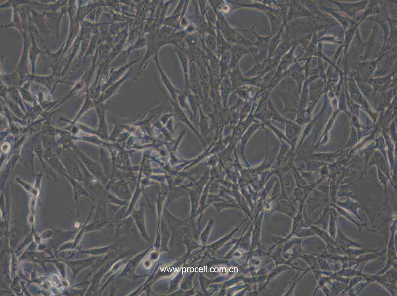 HBZY-1 (大鼠肾小球系膜细胞) (种属鉴定正确)