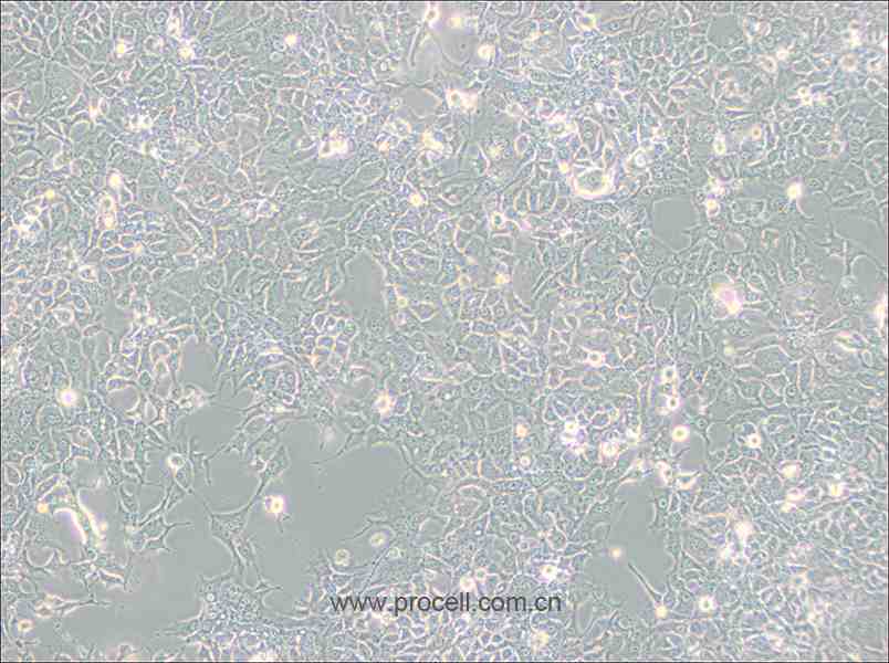 HCC827 (人非小细胞肺癌细胞) (STR鉴定正确)