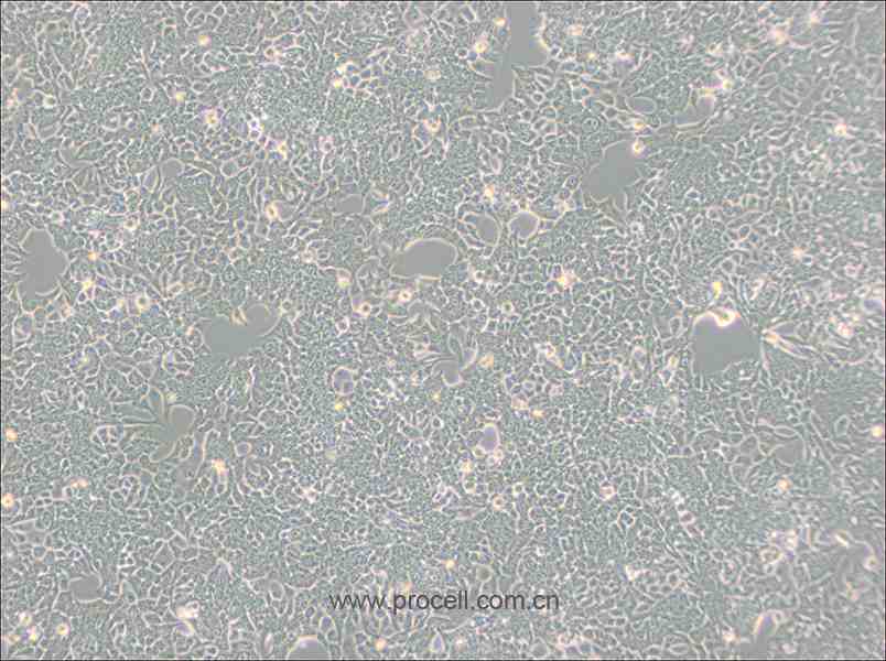 HCT 116 (人结肠癌细胞) (STR鉴定正确)