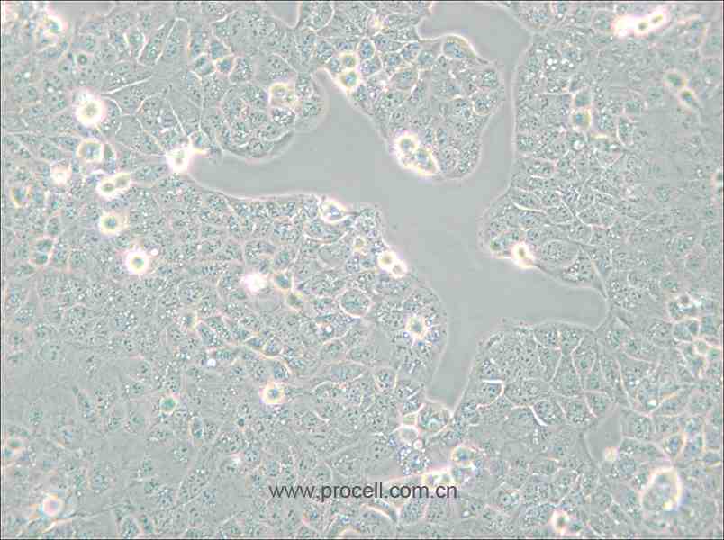 HEC-1-A (人子宫内膜腺癌细胞) (STR鉴定正确)