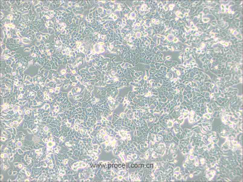 HEC-1-B (人子宫内膜腺癌细胞) (STR鉴定正确)