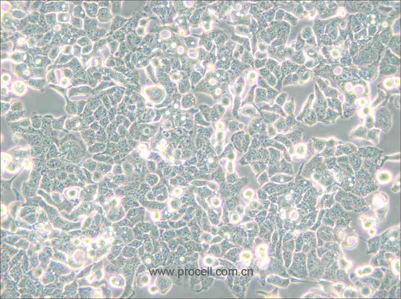 HEC-1-B (人子宫内膜腺癌细胞) (STR鉴定正确)