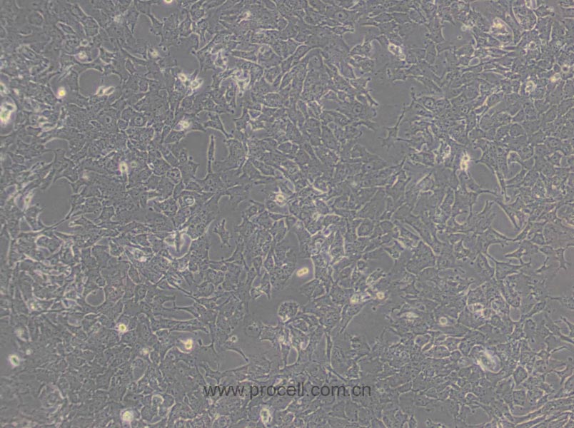 Hepa 1-6 (小鼠肝癌细胞) (STR鉴定正确)