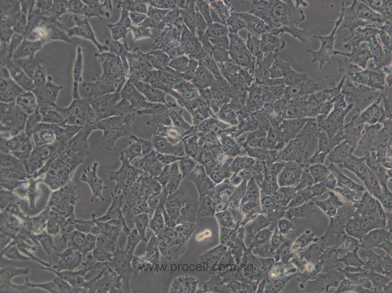 Hepa 1-6 (小鼠肝癌细胞) (STR鉴定正确)
