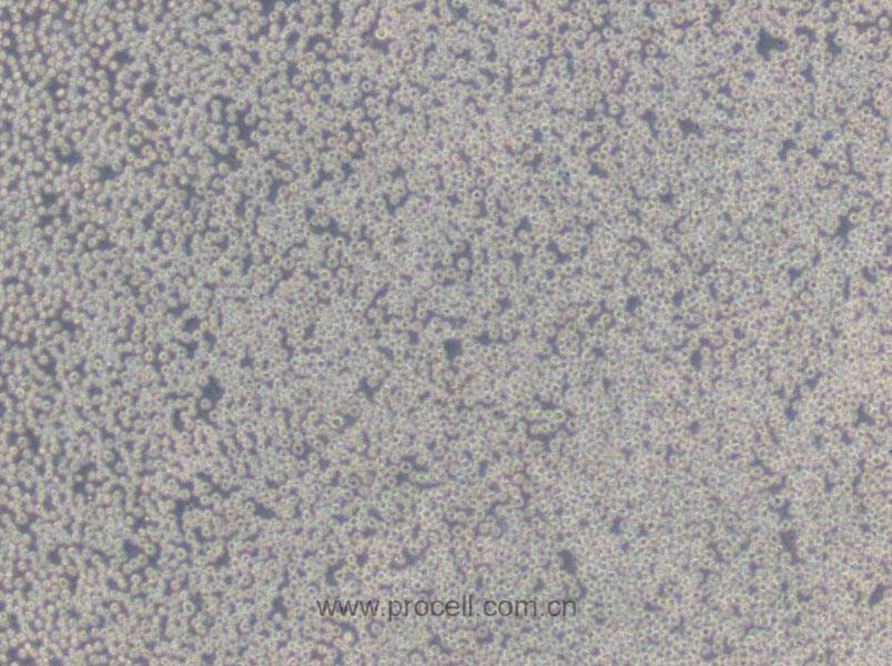 HL-60 (人原髓细胞白血病细胞) (STR鉴定正确)