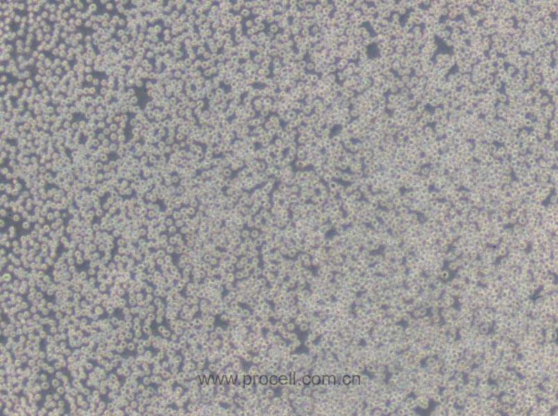 HL-60 (人原髓细胞白血病细胞) (STR鉴定正确)