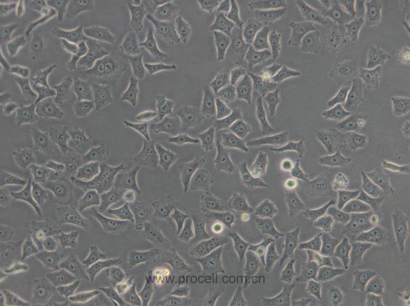 HO-8910 (人卵巢癌细胞) (Hela污染细胞系，暂不供应)