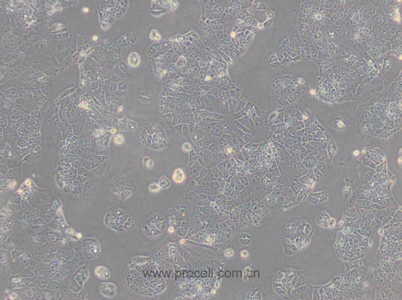 HuH-6 (人肝母细胞瘤细胞) (STR鉴定正确)