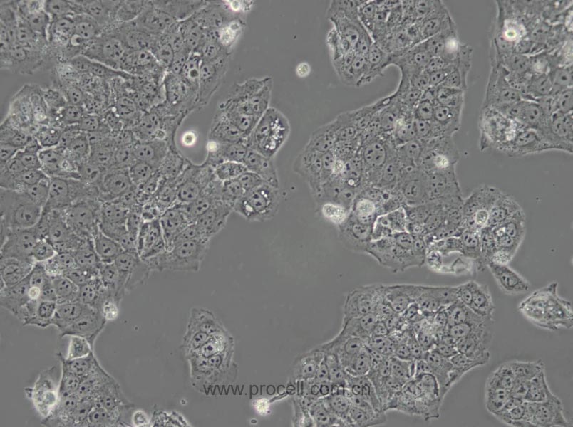 JEG-3 (人绒毛膜癌细胞) (STR鉴定正确)