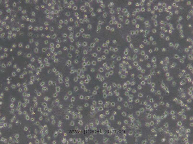 JeKo-1 (人套细胞淋巴瘤细胞) (STR鉴定正确)
