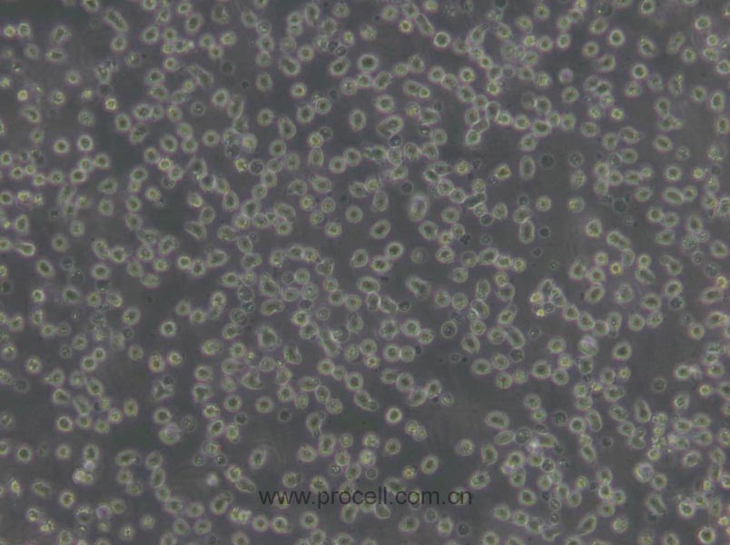 JeKo-1 (人套细胞淋巴瘤细胞) (STR鉴定正确)
