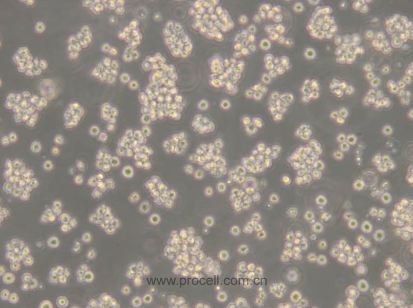 Jurkat, Clone E6-1 (人T淋巴细胞白血病细胞) (STR鉴定正确)