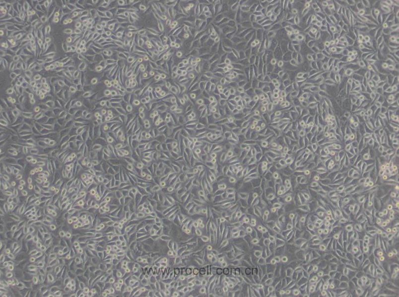 NCTC clone 929 [L cell, L-929] (小鼠成纤维细胞) (STR鉴定正确)