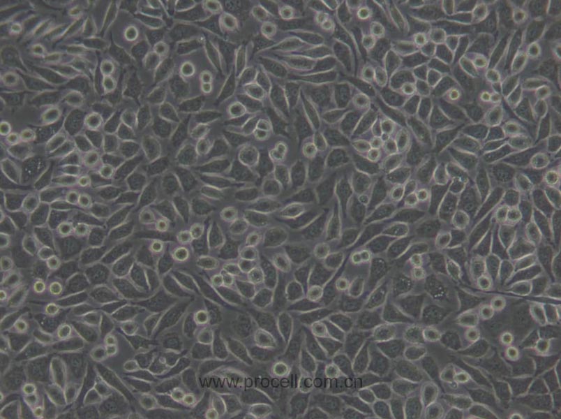 NCTC clone 929 [L cell, L-929] (小鼠成纤维细胞) (STR鉴定正确)