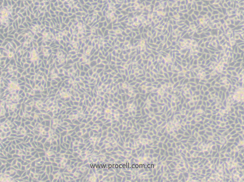 LM/TK [LMTK-] (小鼠胸腺激酶缺陷细胞) (种属鉴定正确)