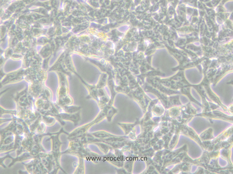 LNCaP clone FGC (人前列腺癌细胞) (STR鉴定正确)