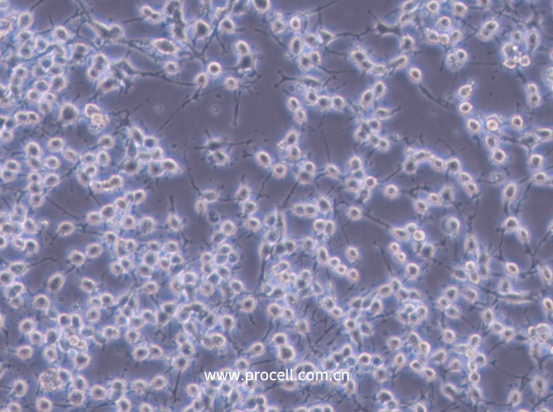 MADB106 (大鼠乳腺癌细胞) (种属鉴定正确)