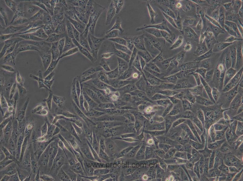MDA-MB-231 (人乳腺癌细胞) (L15) (STR鉴定正确)