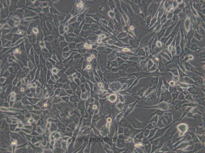 MDA-MB-435S (人乳腺癌细胞/人黑素瘤细胞) (M14污染细胞系，暂不供应)