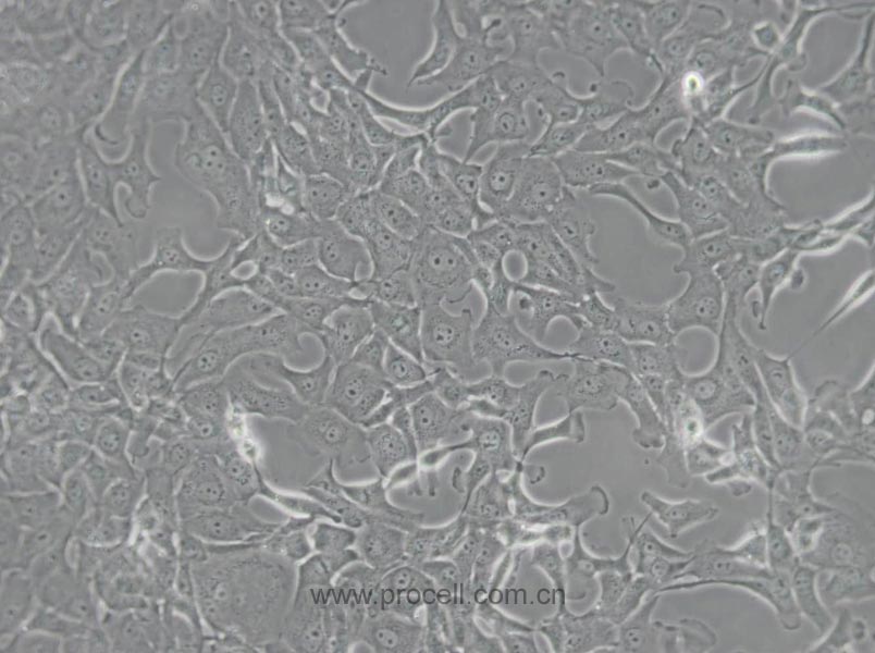 MDBK [NBL-1] (牛肾细胞)(种属鉴定正确)