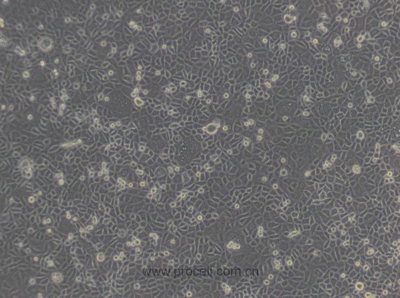 ME-180 (人子宫颈表皮癌细胞) (STR鉴定正确)