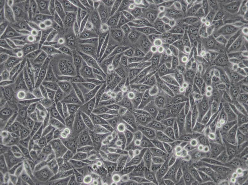 MGC80-3 [MGC-803] (人胃癌细胞) (Hela污染细胞系，暂不供应)