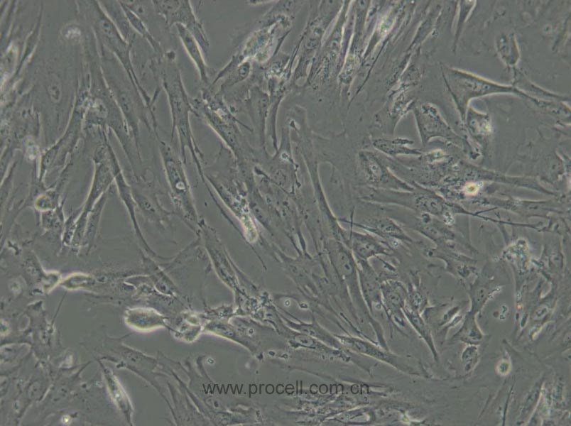 MRC-5 (人胚肺细胞) (STR鉴定正确)