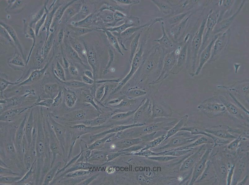MS1 (小鼠胰岛内皮细胞) (STR鉴定正确)
