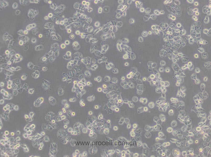 NCI-H1299(人非小细胞肺癌细胞) (STR鉴定正确)