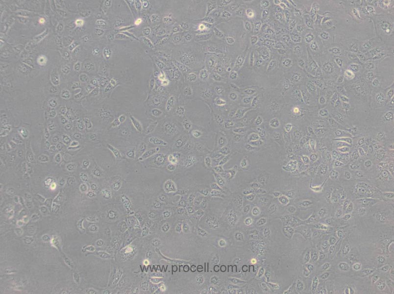 NCI-H1650 (人非小细胞肺癌细胞) (STR鉴定正确)