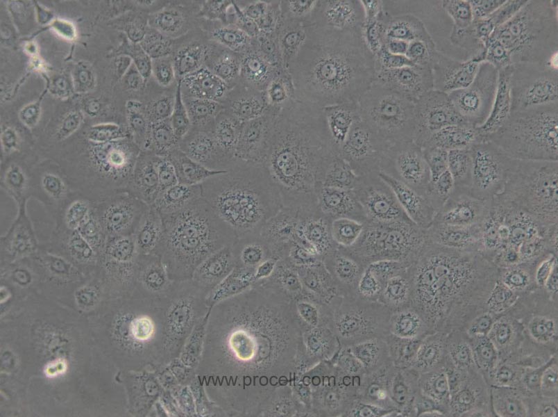 NCI-H1650 (人非小细胞肺癌细胞) (STR鉴定正确)