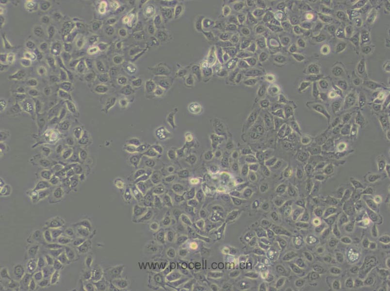 NCI-H292 (人肺癌细胞(淋巴结转移)) (STR鉴定正确)
