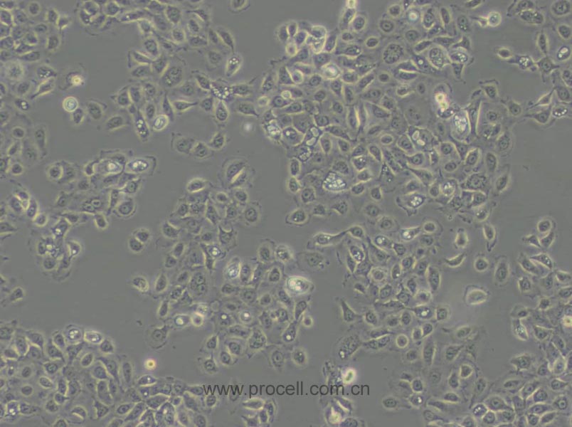 NCI-H292 (人肺癌细胞(淋巴结转移)) (STR鉴定正确)